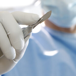 Scalpel Handles
