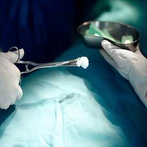 Polypus and Ovum Forceps